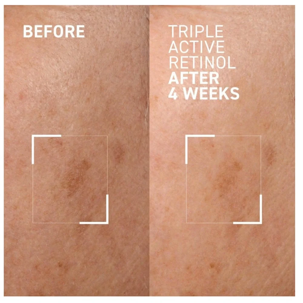 Dr. Brandt Triple Active Retinol Overnight Renewal Cream - Picture 3 of 7